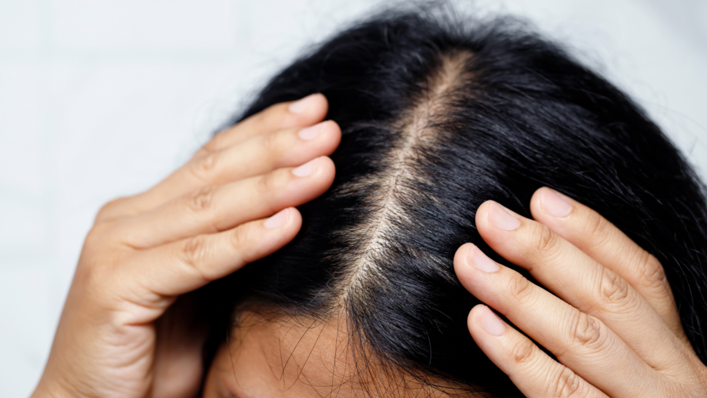 Postpartum hair loss: What to expect